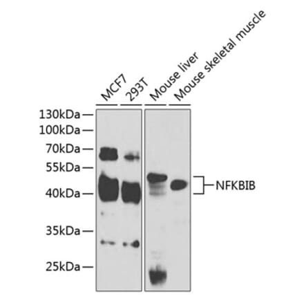 Western Blot - Anti-IKB beta Antibody (A14970) - Antibodies.com