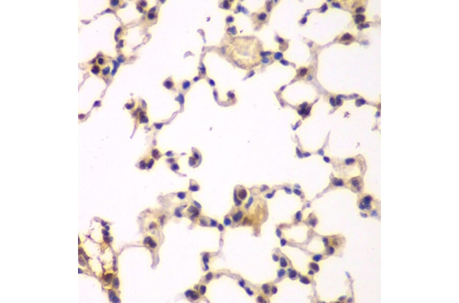 Immunohistochemistry - Anti-IKB beta Antibody (A14970) - Antibodies.com
