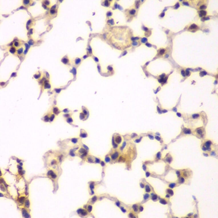 Immunohistochemistry - Anti-IKB beta Antibody (A14970) - Antibodies.com