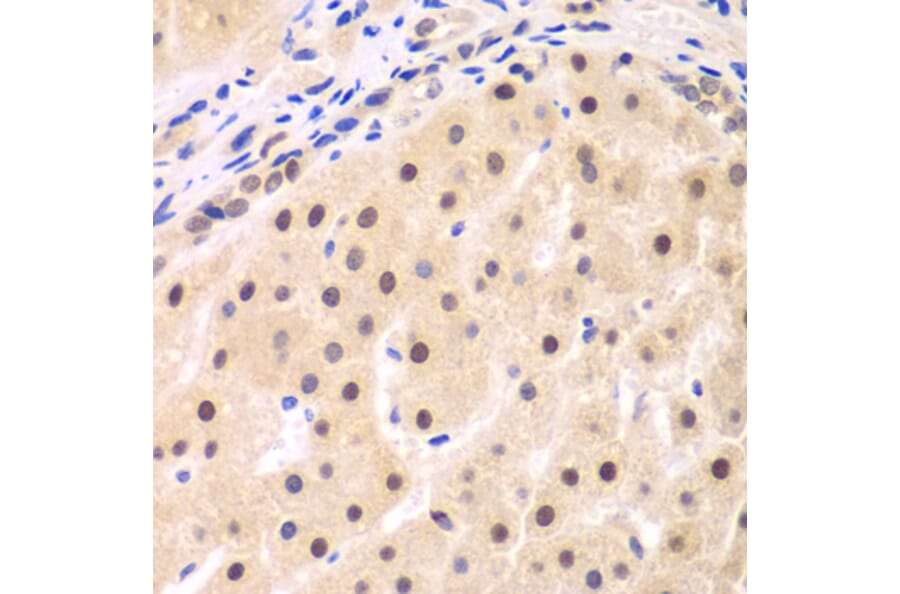 Immunohistochemistry - Anti-IKB beta Antibody (A14970) - Antibodies.com