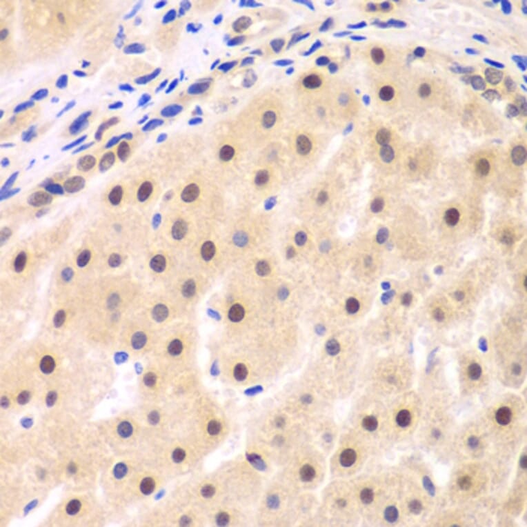 Immunohistochemistry - Anti-IKB beta Antibody (A14970) - Antibodies.com