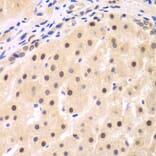 Immunohistochemistry - Anti-IKB beta Antibody (A14970) - Antibodies.com