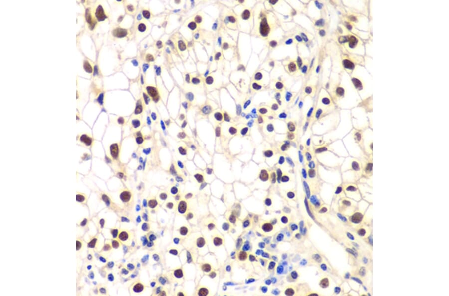 Immunohistochemistry - Anti-IKB beta Antibody (A14970) - Antibodies.com