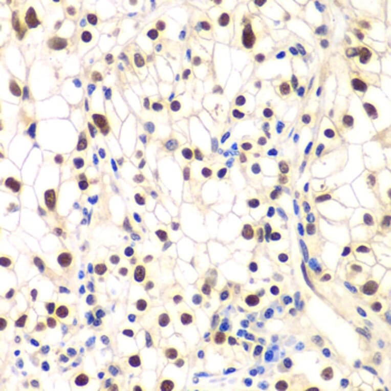 Immunohistochemistry - Anti-IKB beta Antibody (A14970) - Antibodies.com