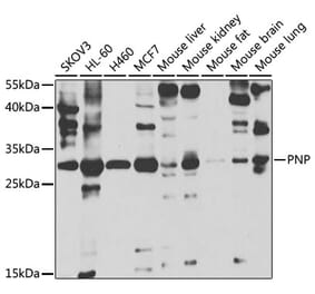 Western Blot - Anti-Nucleoside phosphorylase Antibody (A14971) - Antibodies.com