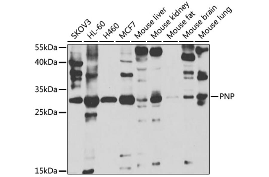Western Blot - Anti-Nucleoside phosphorylase Antibody (A14971) - Antibodies.com