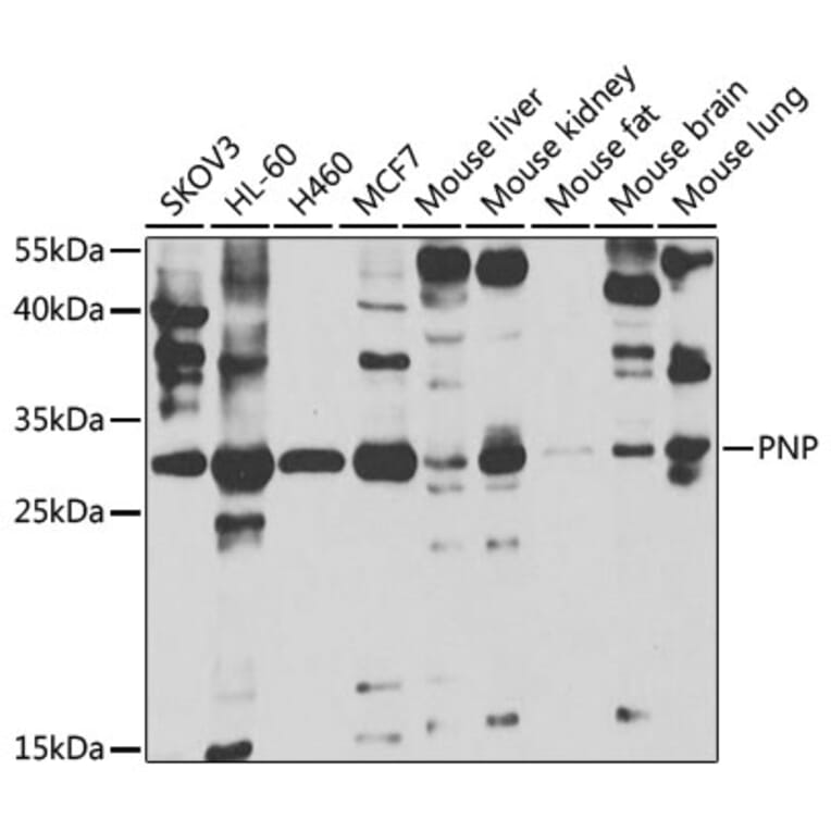 Western Blot - Anti-Nucleoside phosphorylase Antibody (A14971) - Antibodies.com