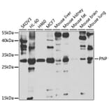 Western Blot - Anti-Nucleoside phosphorylase Antibody (A14971) - Antibodies.com