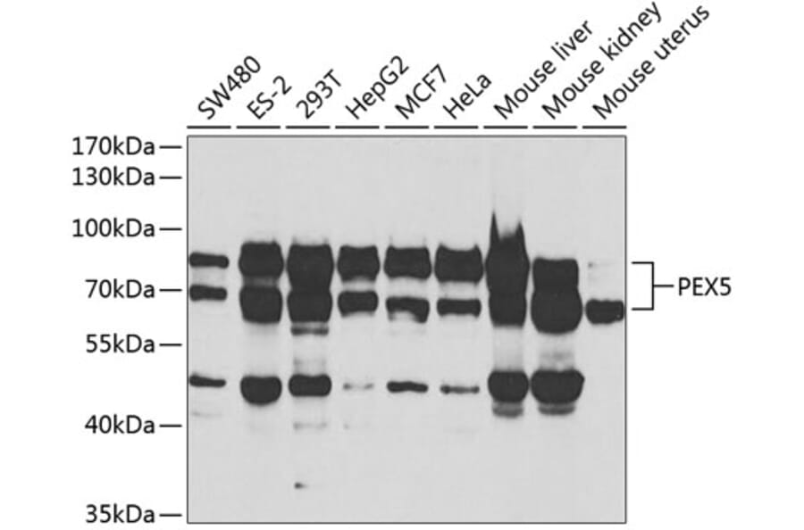 Western Blot - Anti-PEX5/PER3 Antibody (A14972) - Antibodies.com