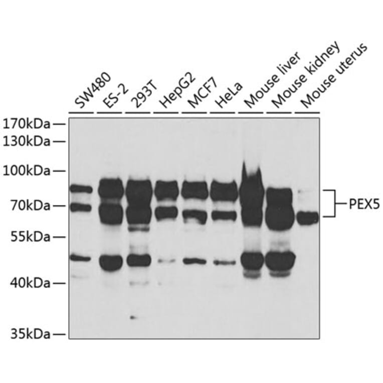 Western Blot - Anti-PEX5/PER3 Antibody (A14972) - Antibodies.com