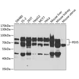 Western Blot - Anti-PEX5/PER3 Antibody (A14972) - Antibodies.com