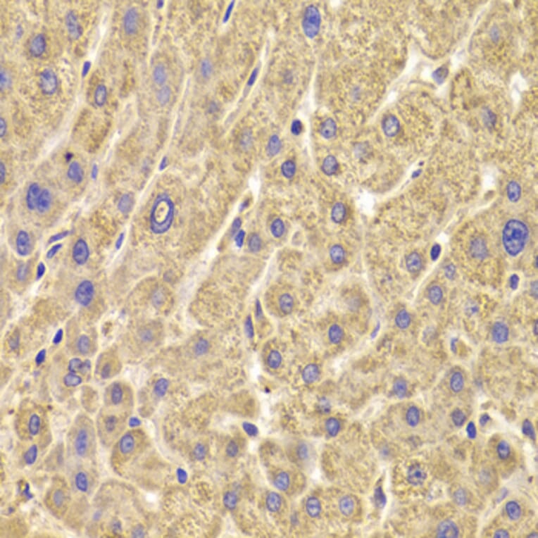 Immunohistochemistry - Anti-PEX5/PER3 Antibody (A14972) - Antibodies.com