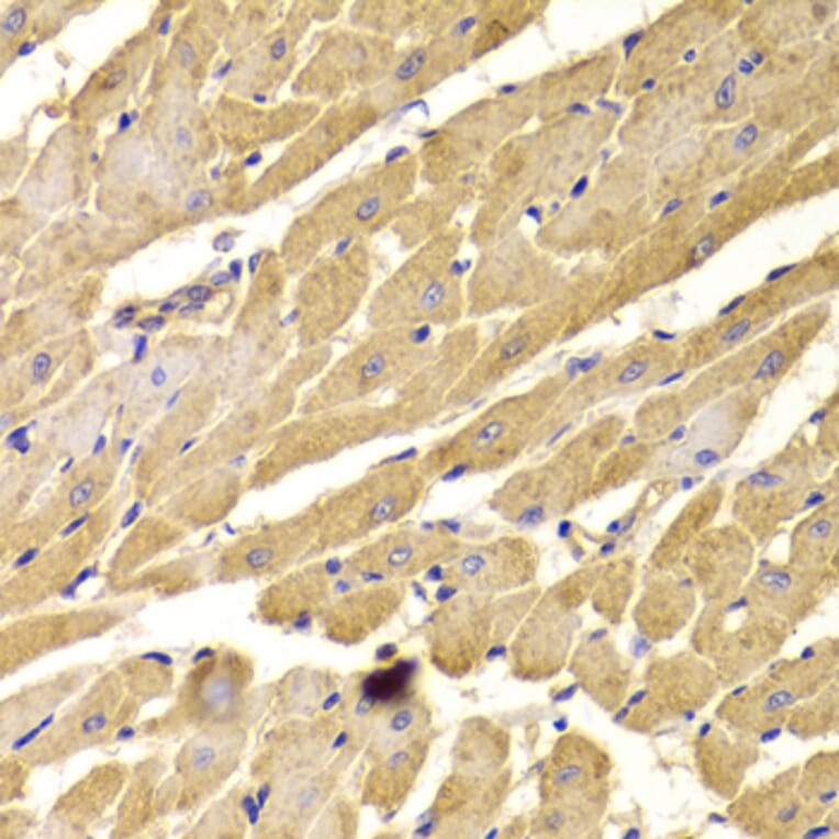Immunohistochemistry - Anti-PEX5/PER3 Antibody (A14972) - Antibodies.com