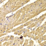 Immunohistochemistry - Anti-PEX5/PER3 Antibody (A14972) - Antibodies.com
