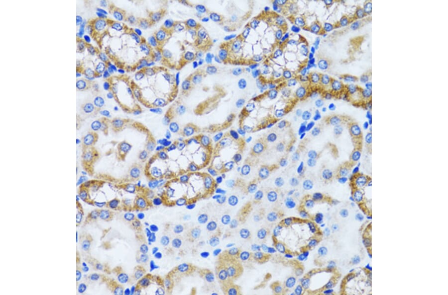 Immunohistochemistry - Anti-PEX5/PER3 Antibody (A14972) - Antibodies.com
