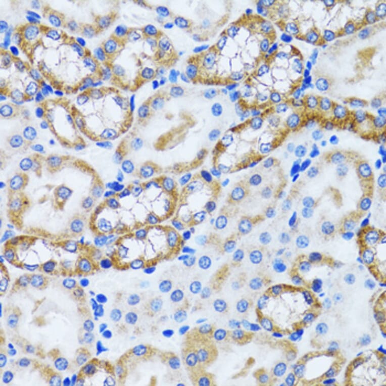 Immunohistochemistry - Anti-PEX5/PER3 Antibody (A14972) - Antibodies.com