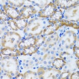 Immunohistochemistry - Anti-PEX5/PER3 Antibody (A14972) - Antibodies.com