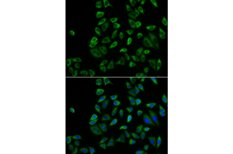 Immunofluorescence - Anti-PEX5/PER3 Antibody (A14972) - Antibodies.com