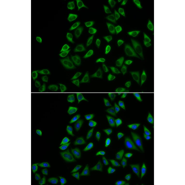 Immunofluorescence - Anti-PEX5/PER3 Antibody (A14972) - Antibodies.com