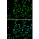 Immunofluorescence - Anti-PEX5/PER3 Antibody (A14972) - Antibodies.com