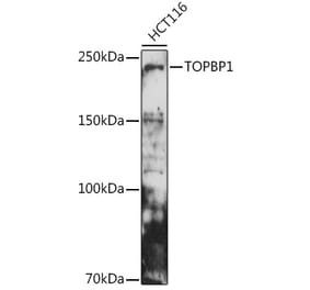 Western Blot - Anti-TopBP1 Antibody (A14973) - Antibodies.com