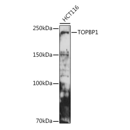 Western Blot - Anti-TopBP1 Antibody (A14973) - Antibodies.com