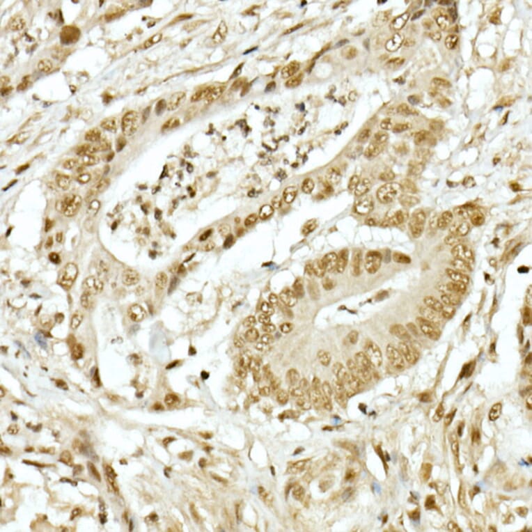 Immunohistochemistry - Anti-TopBP1 Antibody (A14973) - Antibodies.com