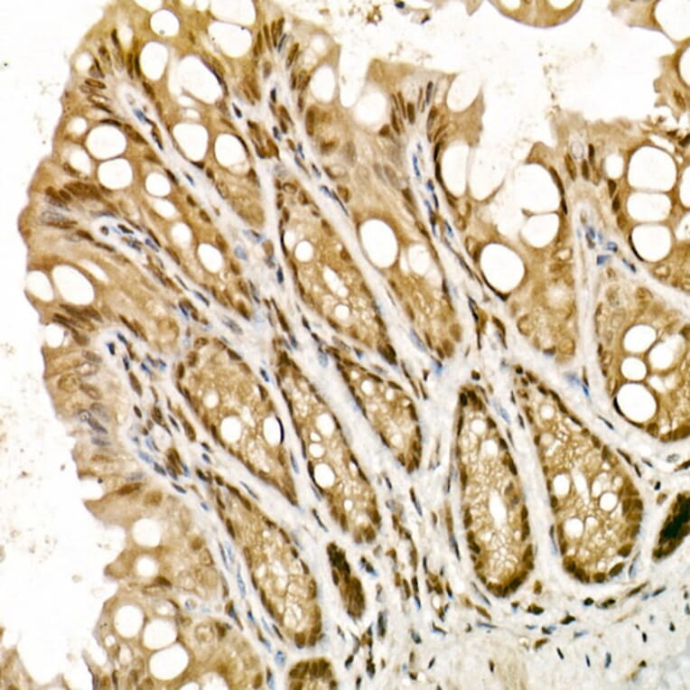 Immunohistochemistry - Anti-TopBP1 Antibody (A14973) - Antibodies.com
