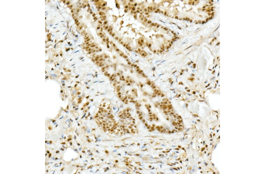 Immunohistochemistry - Anti-TopBP1 Antibody (A14973) - Antibodies.com