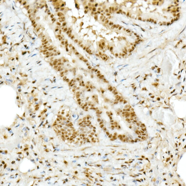 Immunohistochemistry - Anti-TopBP1 Antibody (A14973) - Antibodies.com