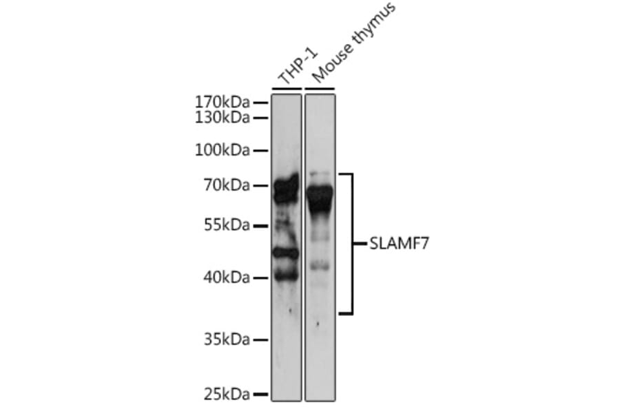 Western Blot - Anti-SLAMF7/CS1 Antibody (A14974) - Antibodies.com