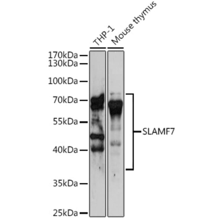Western Blot - Anti-SLAMF7/CS1 Antibody (A14974) - Antibodies.com
