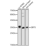 Western Blot - Anti-SIRT5 Antibody (A14975) - Antibodies.com