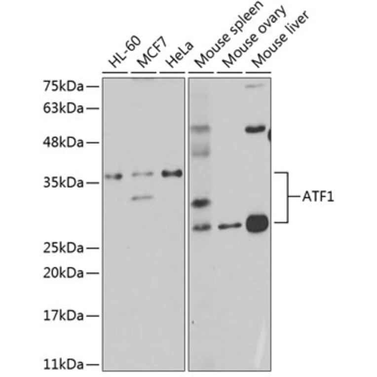 Western Blot - Anti-ATF1 Antibody (A14976) - Antibodies.com