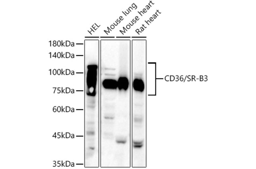 Western Blot - Anti-CD36 Antibody (A14977) - Antibodies.com