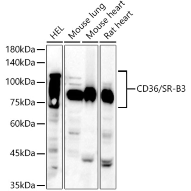 Western Blot - Anti-CD36 Antibody (A14977) - Antibodies.com