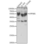 Western Blot - Anti-ATP1B1 Antibody (A14978) - Antibodies.com