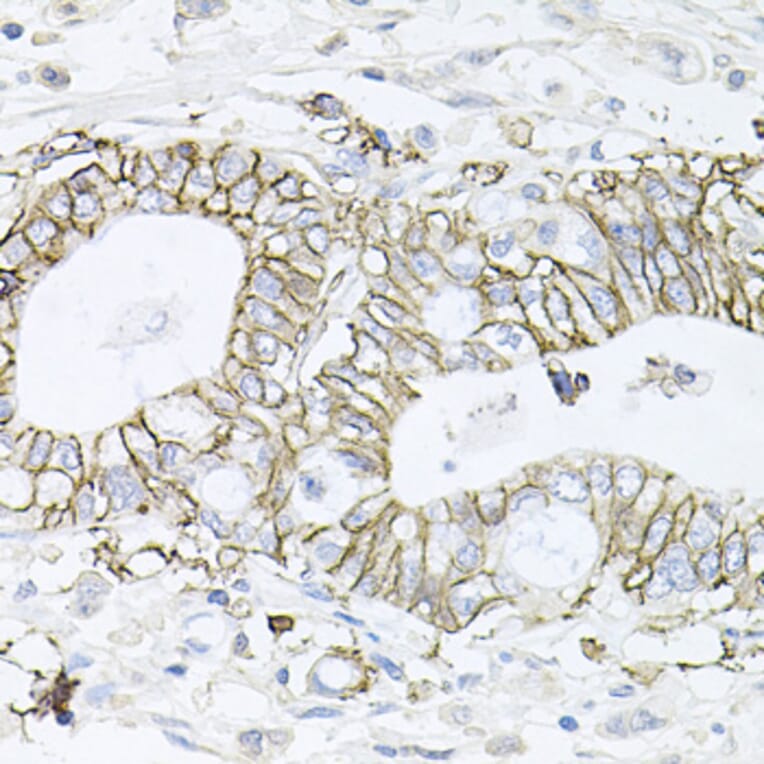 Immunohistochemistry - Anti-ATP1B1 Antibody (A14978) - Antibodies.com