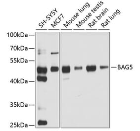 Western Blot - Anti-BAG5 Antibody (A5794) - Antibodies.com