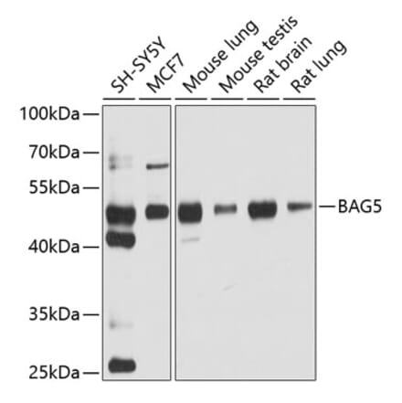 Western Blot - Anti-BAG5 Antibody (A5794) - Antibodies.com