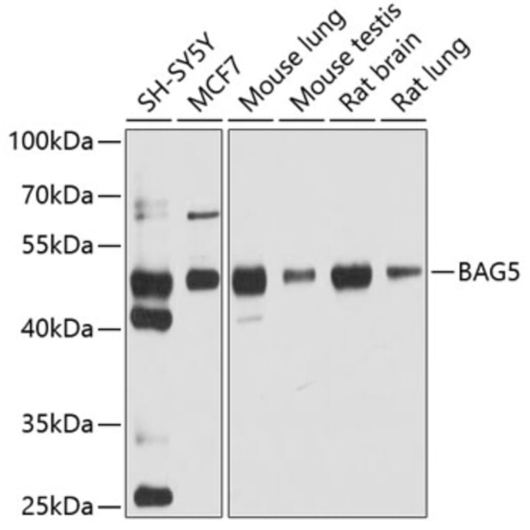 Western Blot - Anti-BAG5 Antibody (A5794) - Antibodies.com