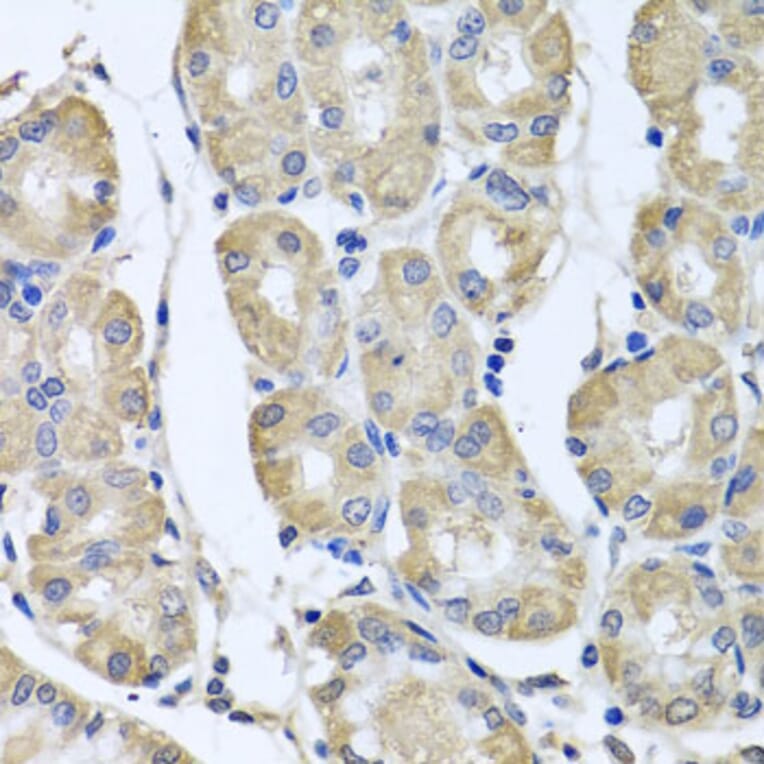 Immunohistochemistry - Anti-BAG5 Antibody (A5794) - Antibodies.com