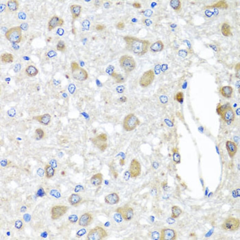 Immunohistochemistry - Anti-BAG5 Antibody (A5794) - Antibodies.com