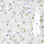 Immunohistochemistry - Anti-BAG5 Antibody (A5794) - Antibodies.com