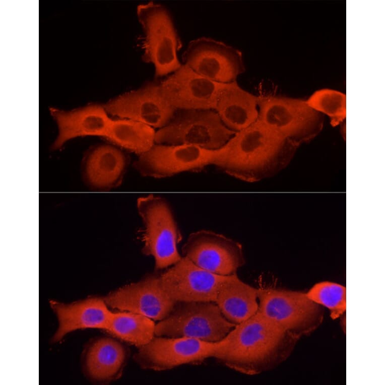 Immunofluorescence - Anti-Cortactin Antibody (A14980) - Antibodies.com
