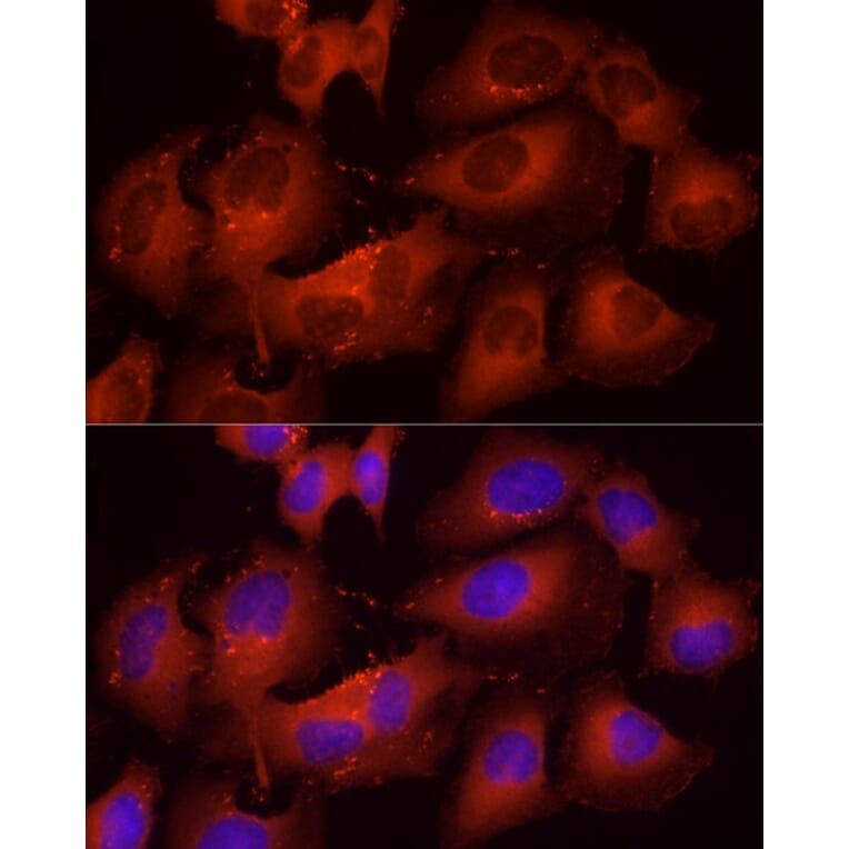 Immunofluorescence - Anti-Cortactin Antibody (A14980) - Antibodies.com