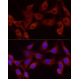 Immunofluorescence - Anti-Cortactin Antibody (A14980) - Antibodies.com