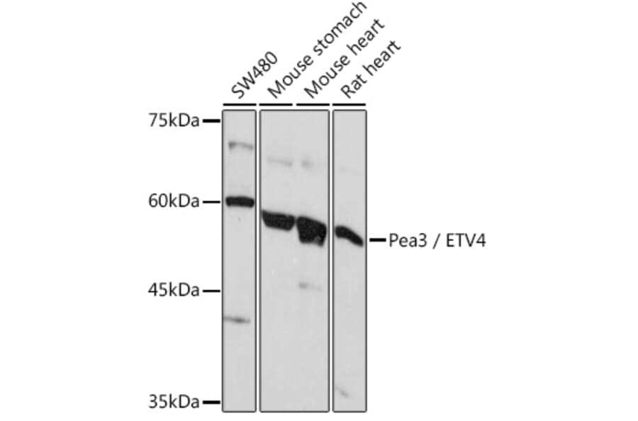 Western Blot - Anti-Pea3 Antibody (A14982) - Antibodies.com