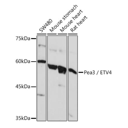 Western Blot - Anti-Pea3 Antibody (A14982) - Antibodies.com