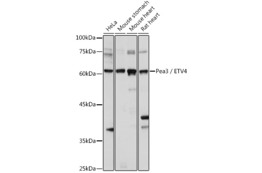 Western Blot - Anti-Pea3 Antibody (A14982) - Antibodies.com